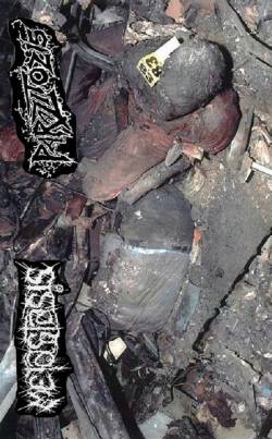 Parazitózis : Metastasis - Parazitozis